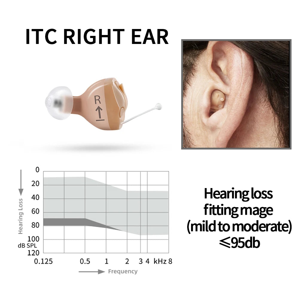 Rexton InoX 5A Invisible ITC CIC Digital Hearing Aid with App Control, 8 Channels
