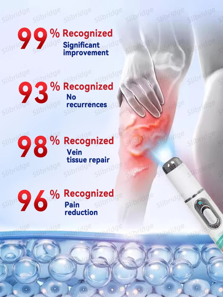 Leg Care Blue Light Therapy Pen – Varicose Vein Treatment Tool, 2025 Hot Sale