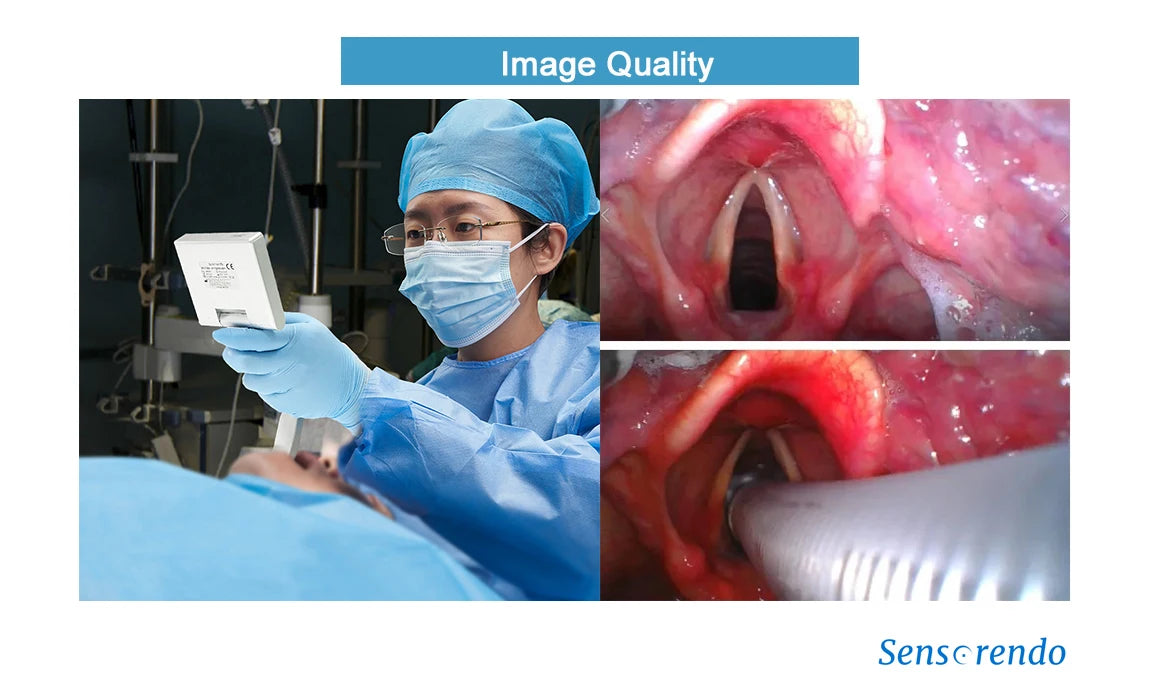 " Digital Video Laryngoscope – Touchscreen Anesthesia Scope with Reusable Blades